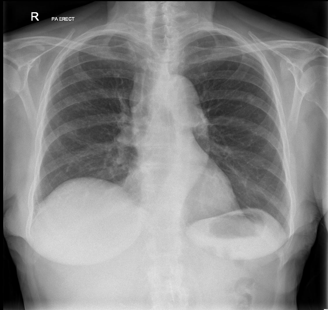 Case 4